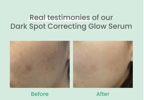 AXIS-Y Dark Spot Correcting Glow Serum - Reduce signs of hyper pigmentation, scarring and sun damage | SunSkincare