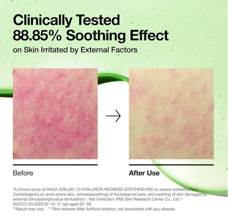 Anua Azelaic 10 Hyaluron Soothing Pad Canada – Before and After Use (88.85% Soothing Effects) | SunSkincare