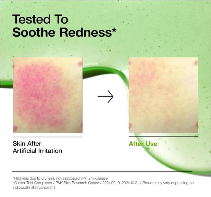 Anua Azelaic Acid 10 Hyaluron Soothing Serum Canada – Before and After Use | SunSkincare