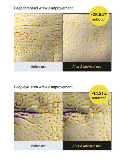Celimax Retinol Shot Tightening Booster – Before and After: Wrinkle Improvement | SunSkincare