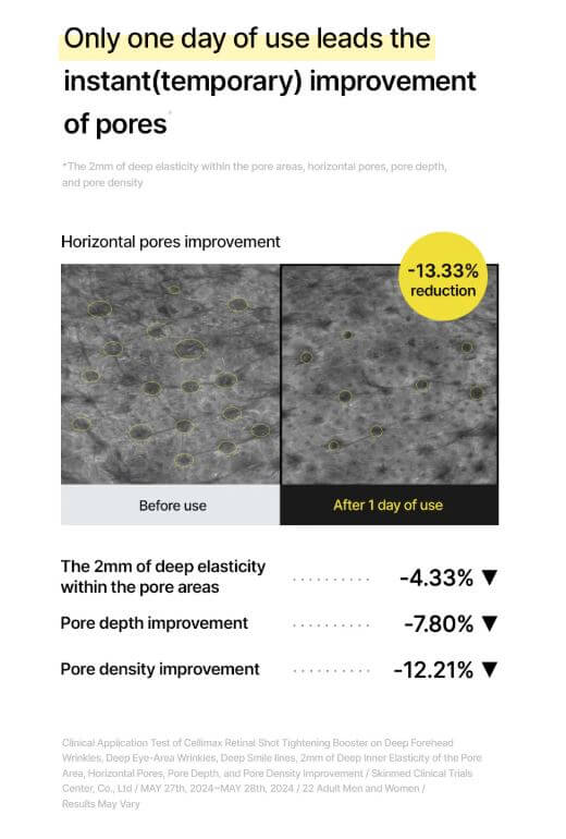 Celimax Retinol Shot Tightening Booster - Before and After: Pores Improvement | SunSkincare