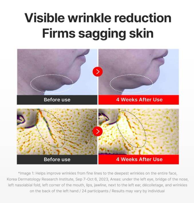 Centellian24 Madeca Cream Time Reverse – Firm Sagging Skin: Before and After | SunSkincare