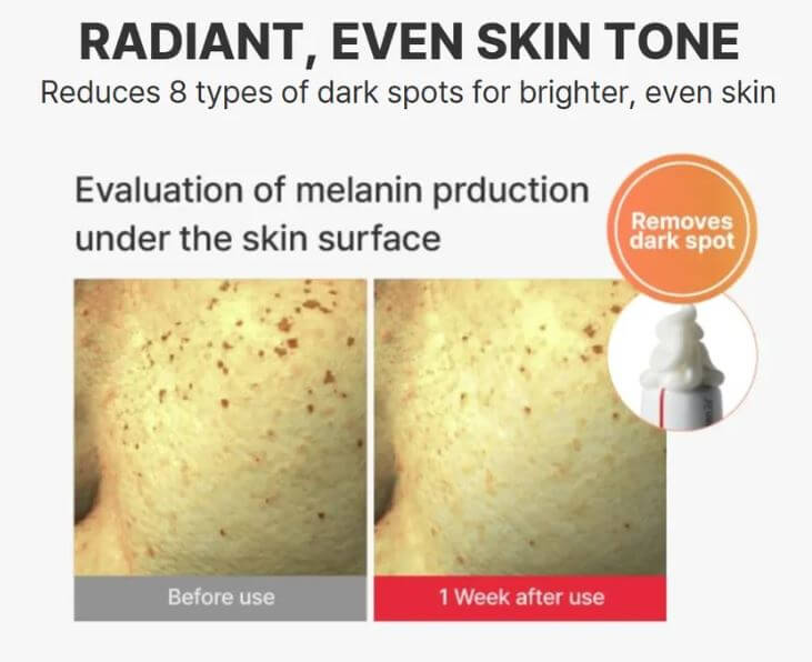 Centellian 24 Madeca Cream Time Reverse – Fade Dark Spots: Before and After | SunSkincare
