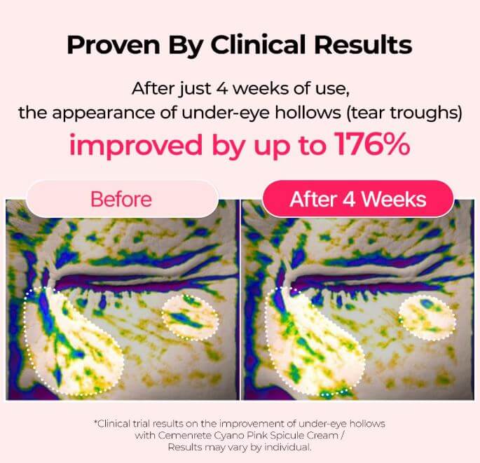 Dr.Melaxin Pink Spicule Cream Canada – Before and After Use | SunSkincare
