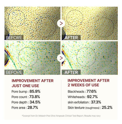 Dr.Melaxin Peel Shot Exfoliating White Rice Ampoule - Before and After Use | SunSkincare