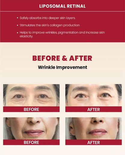 K-SECRET SEOUL 1988 Cream : Retinal Liposome 1% + Fermented Rice | Before and After | SunSkincare