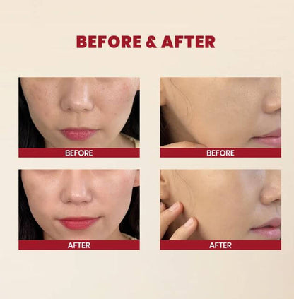 K-Secret SEOUL 1988 Essence : Snail Mucin 97% + Rice – Before and After Use | SunSkincare