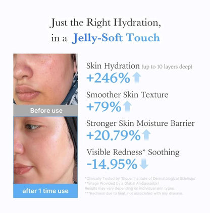Medicube Hyaluronic Ceramide Jelly Cream – Before and After Use | SunSkincare