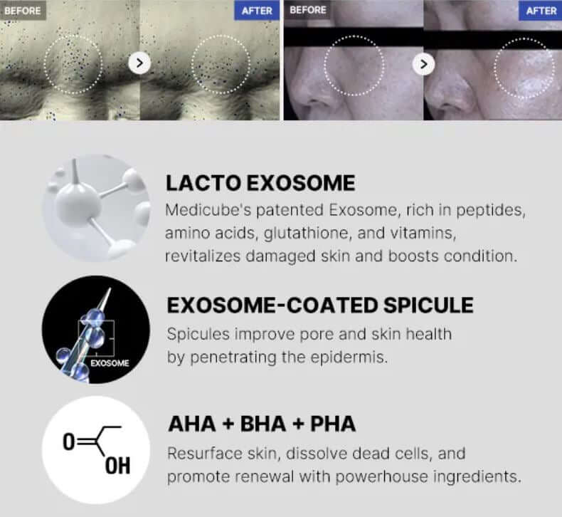 Medicube One Day Exosome Shot 7500 – Before and After Use | SunSkincare