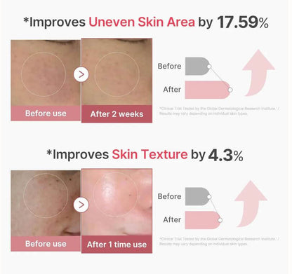 Medicube PDRN Pink Collagen Exosome Shot 2000 – Before and After Use | SunSkincare