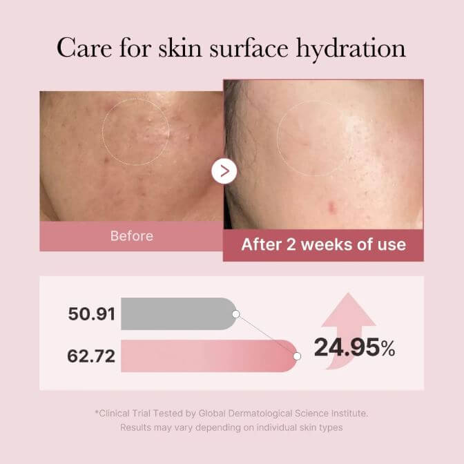 Medicube PDRN Pink Glutathione Serum Mist – Before and After Use | SunSkincare