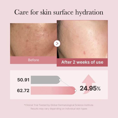 Medicube PDRN Pink Glutathione Serum Mist – Before and After Use | SunSkincare