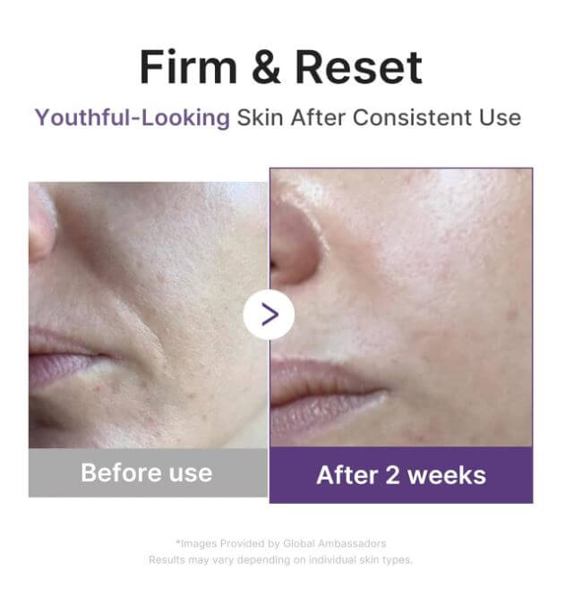 Medicube Retinol Boosting Serum – Before and After | SunSkincare