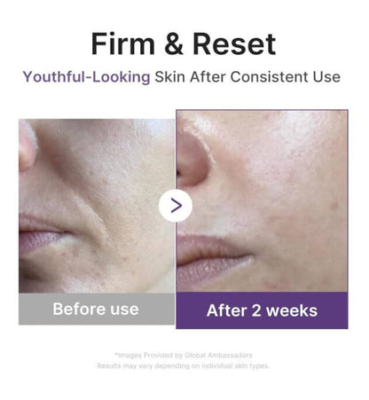 Medicube Retinol Boosting Serum – Before and After | SunSkincare