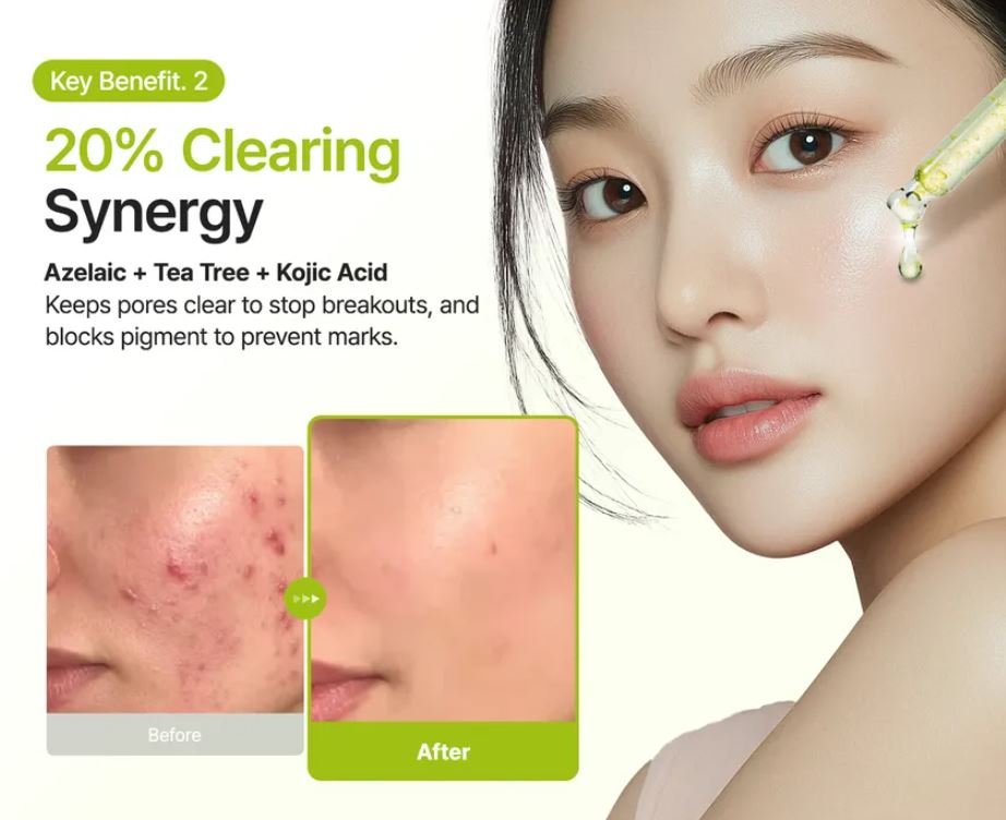 Purito Azelaic Acid Serum – Key Benefits, Before and After | SunSkincare