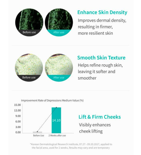 REJURAN Turnover Ampoule Canada – Before and After Use | SunSkincare