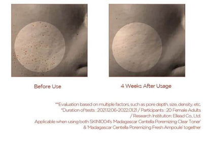 SKIN1004 Madagascar Centella Poremizing Fresh Ampoule – Before and After Use | SunSkincare