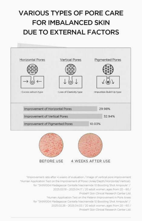 SKIN1004 Niacinamide 10 Boosting Shot Ampoule – Pore Care Before and After Use | SunSkincare