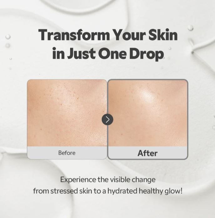 TIRTIR SOS Serum – Before and After | SunSkincare