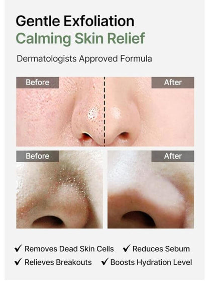 celimax Heartleaf BHA Peeling Pad Canada-Before and After | SunSkincare