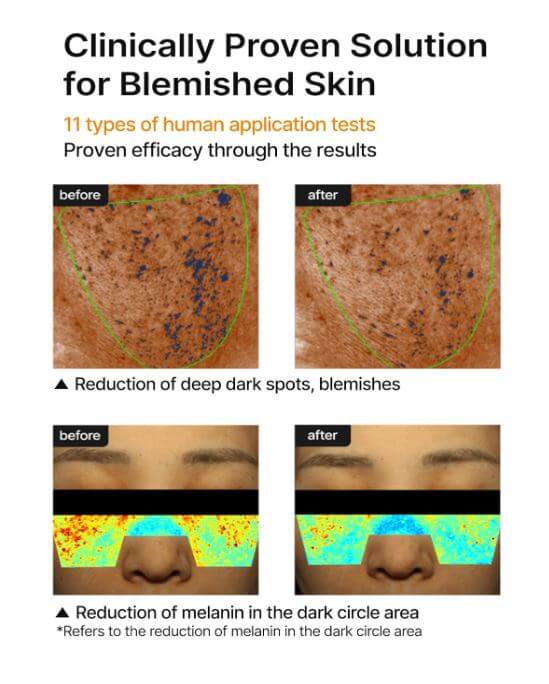 celimax Dark Spot Cream Canada – Before and After Use | SunSkincare