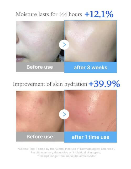 Medicube Multi Peptide Serum – Before and After | Medicube Canada | SunSkincare