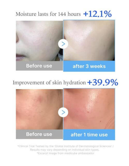 Medicube Multi Peptide Serum – Before and After | Medicube Canada | SunSkincare