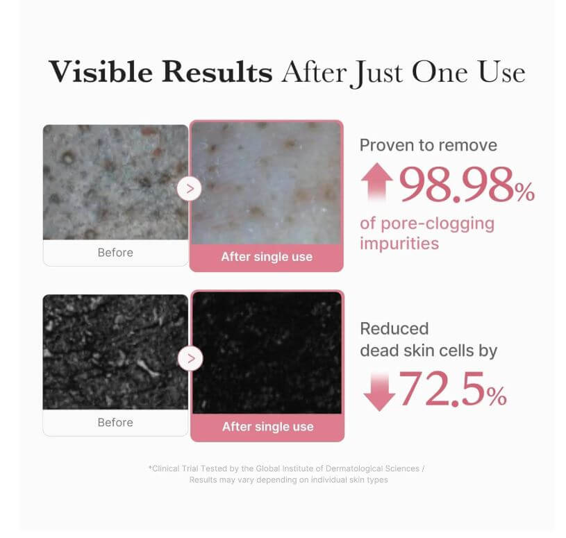 medicube PDRN Pink Niacinamide Whip Cleanser – Before and After | SunSkincare