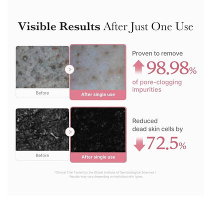 medicube PDRN Pink Niacinamide Whip Cleanser – Before and After | SunSkincare