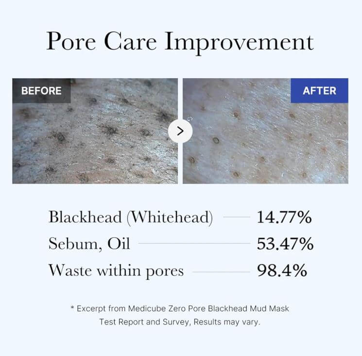 medicube Zero Pore Blackhead Mud Mask – Pore Improvement Results | SunSkincare