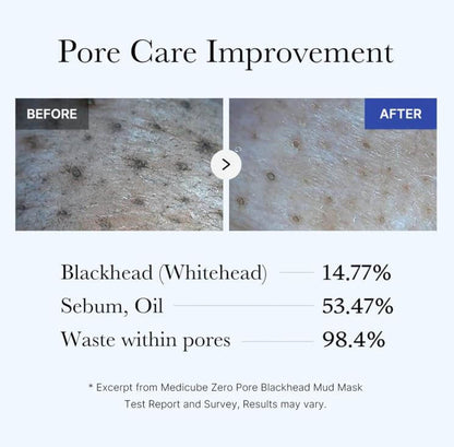 medicube Zero Pore Blackhead Mud Mask – Pore Improvement Results | SunSkincare